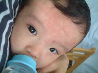 赤ちゃんの突発性発疹の症状・画像 - Photo No.1