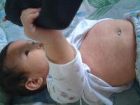 赤ちゃんの突発性発疹の症状・画像 - Photo No.3